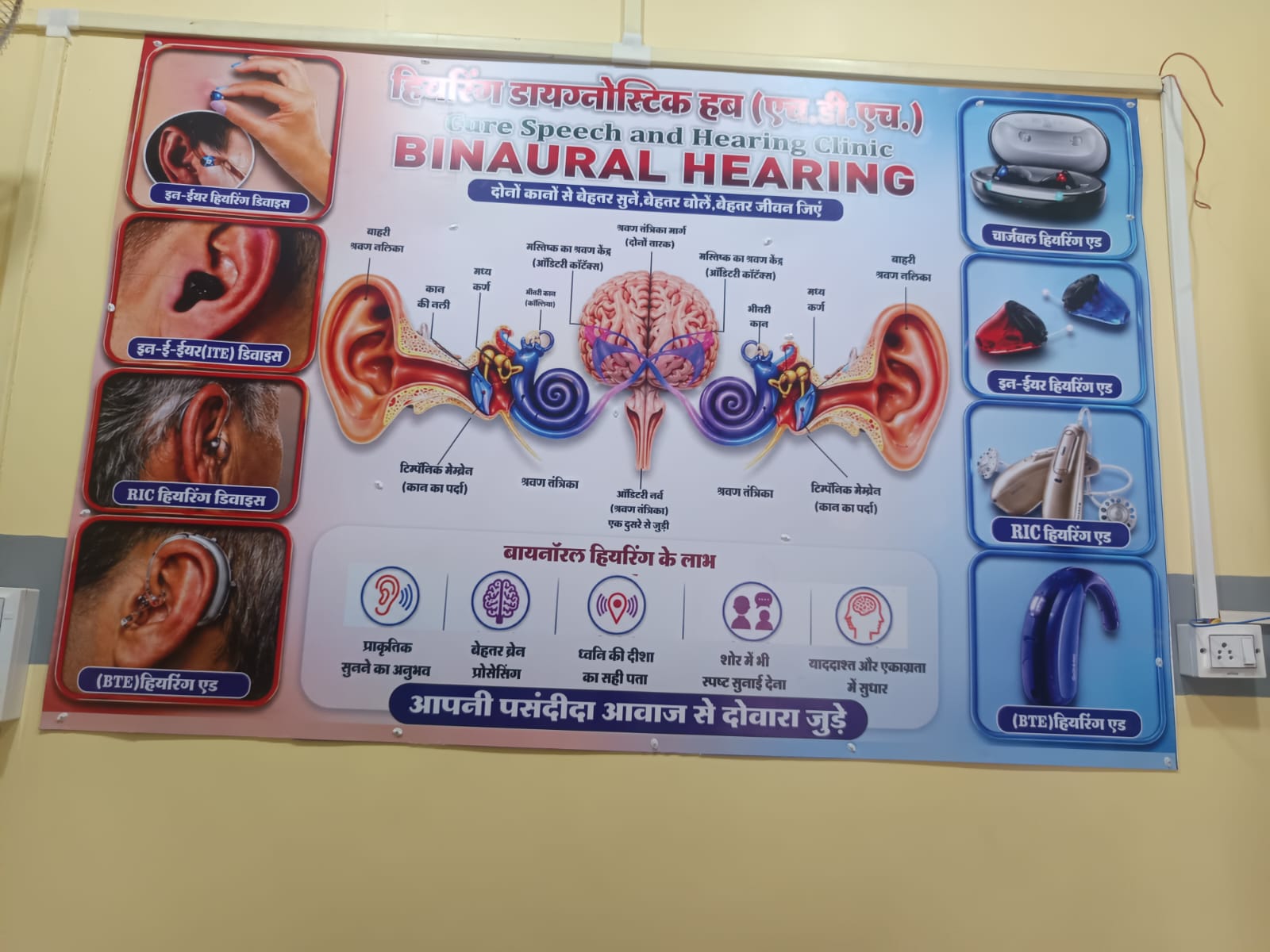 Binaural hearing information